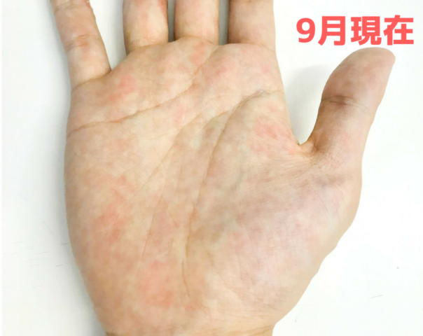 手相 変化 期間 周期 左手 写真 運命 現在の手のひら 赤い文字 血行が悪そう