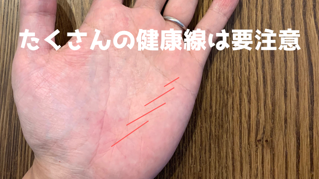 手相　健康線　赤ちゃん　結婚線　スター　財運線　赤い線がたくさん